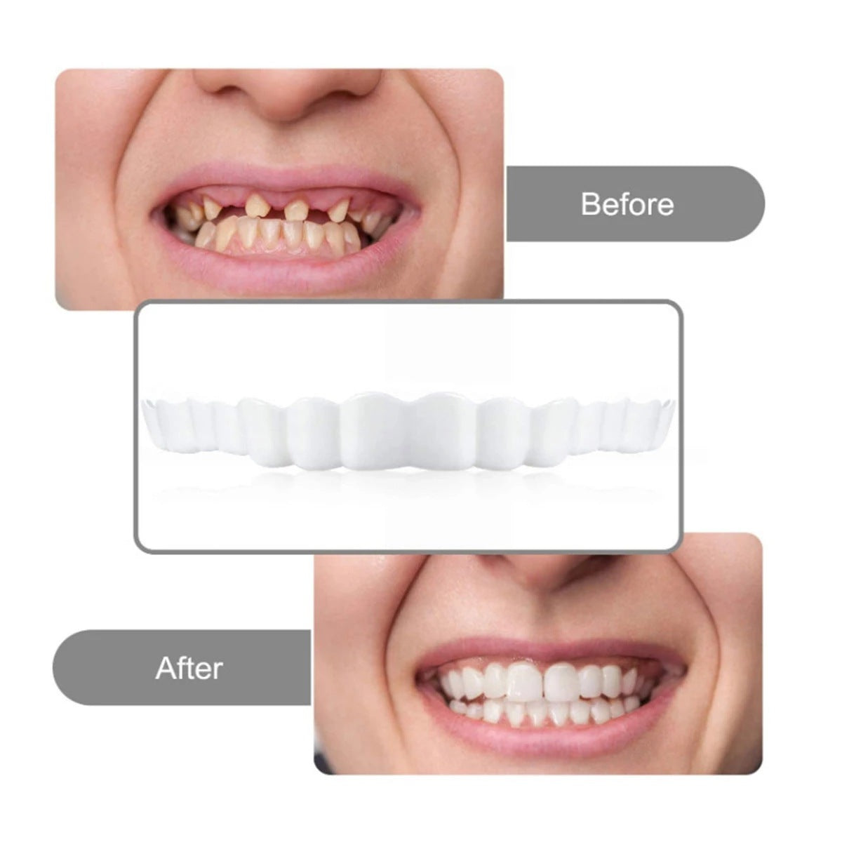 CARILLAS POSTIZA DENTADURA SNAP ON SMILE