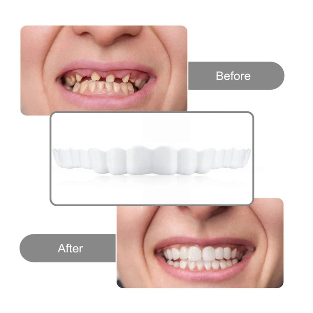 CARILLAS POSTIZA DENTADURA SNAP ON SMILE