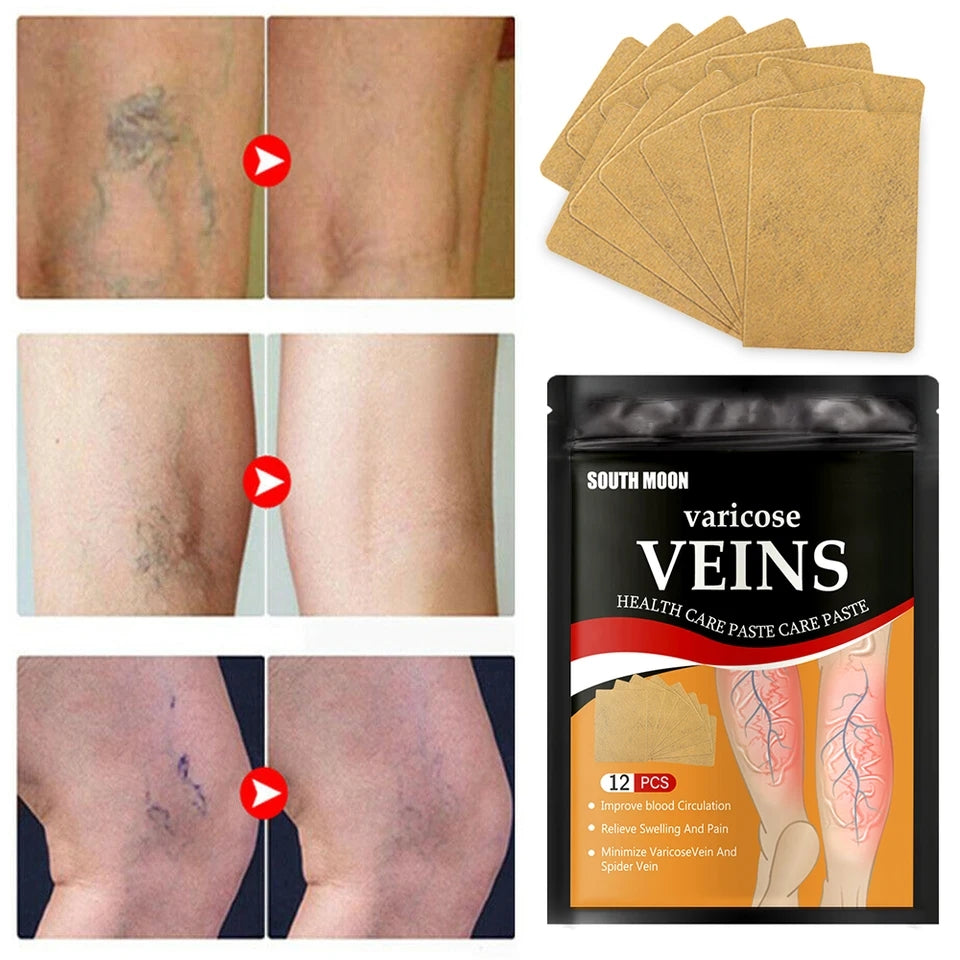 36 PARCHES VARICES